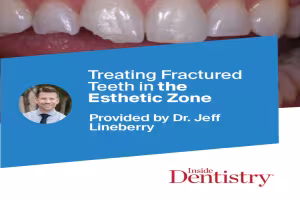 Ecosite Elements Showcased in Inside Dentistry for Breakthrough Esthetic Restoration