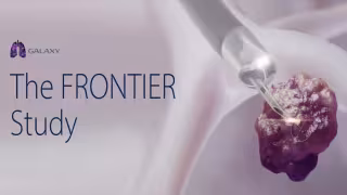 Noah Medical's Galaxy System Hits 100% Tool-in-Lesion Accuracy in Trial