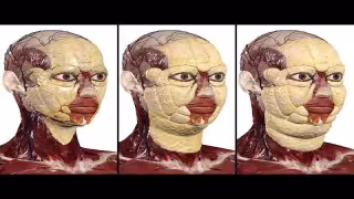 Anatomage Adds Class I, Class III Obesity Models to 3D Table