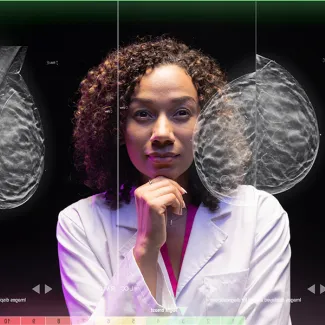 Hologic Presents Groundbreaking AI-Powered Mammography Technology at SBI 2025 Symposium