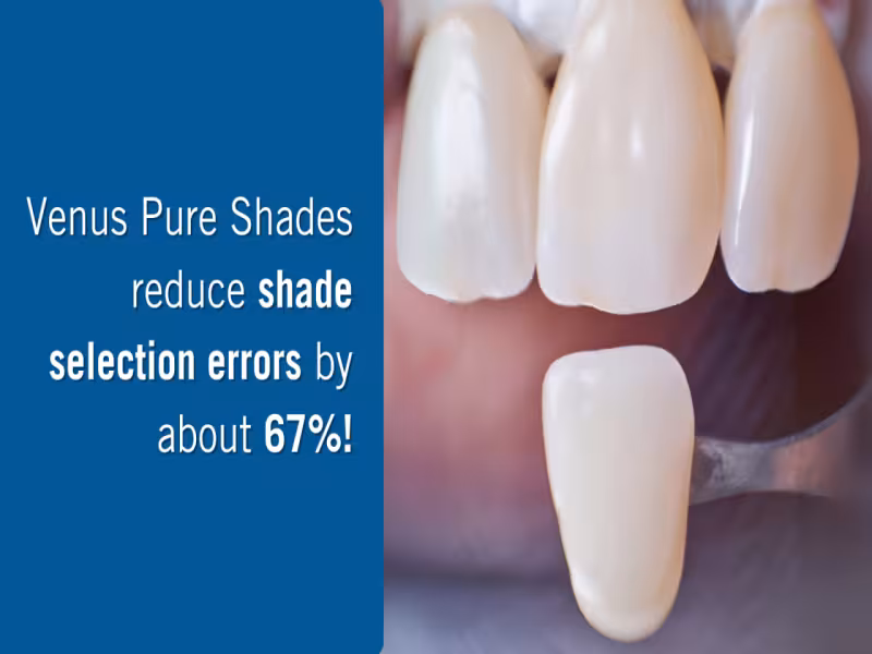 Study Confirms Simplified Layering Achieves Exceptional Aesthetic Results in Restorative Dentistry