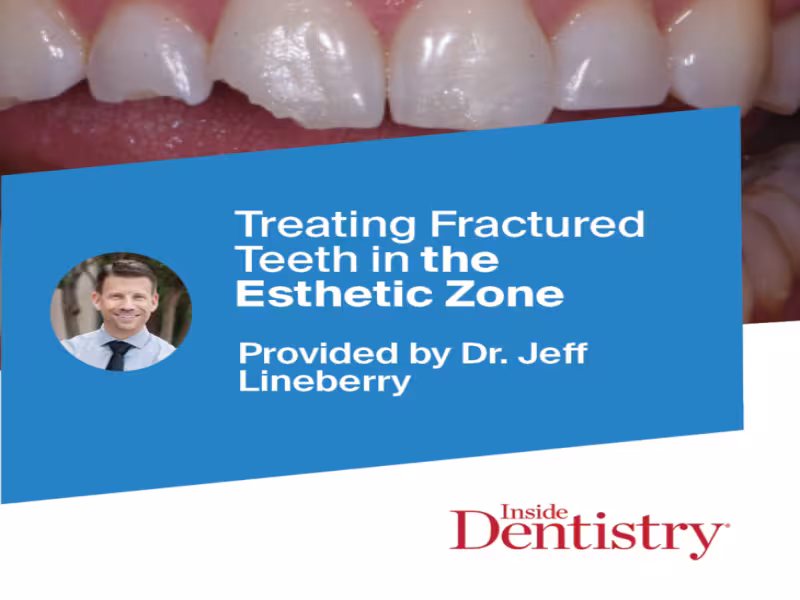Ecosite Elements Showcased in Inside Dentistry for Breakthrough Esthetic Restoration
