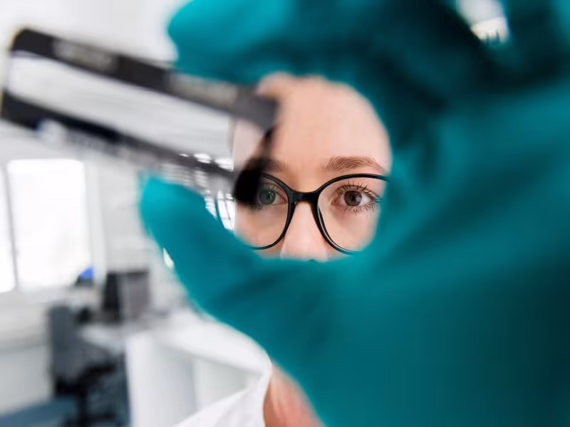 Roche Launches Elecsys PRO-C3 Test to Revolutionize Liver Fibrosis Diagnosis