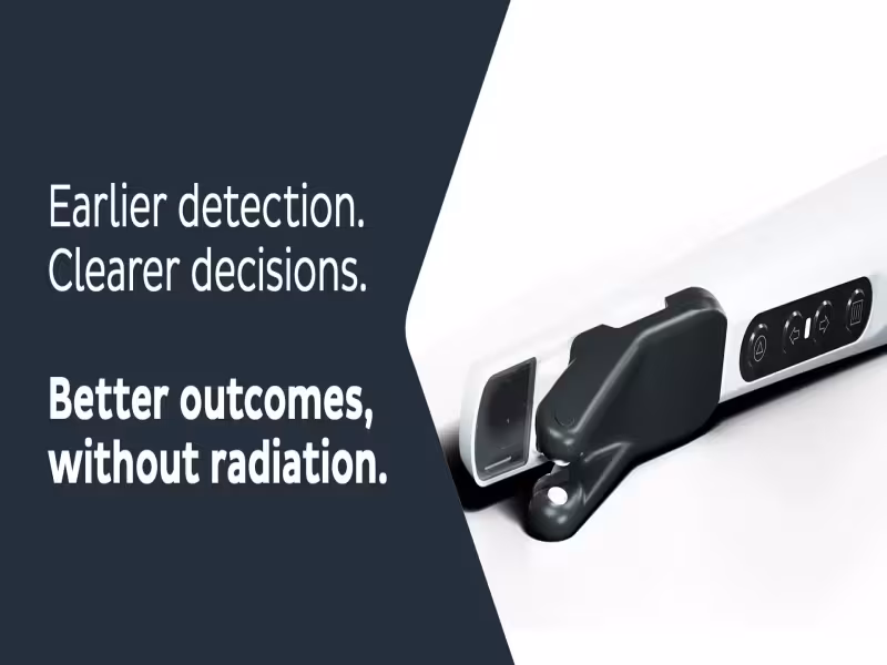 Empowering Early Caries Management with KaVo DIAGNOcam Vision Full HD