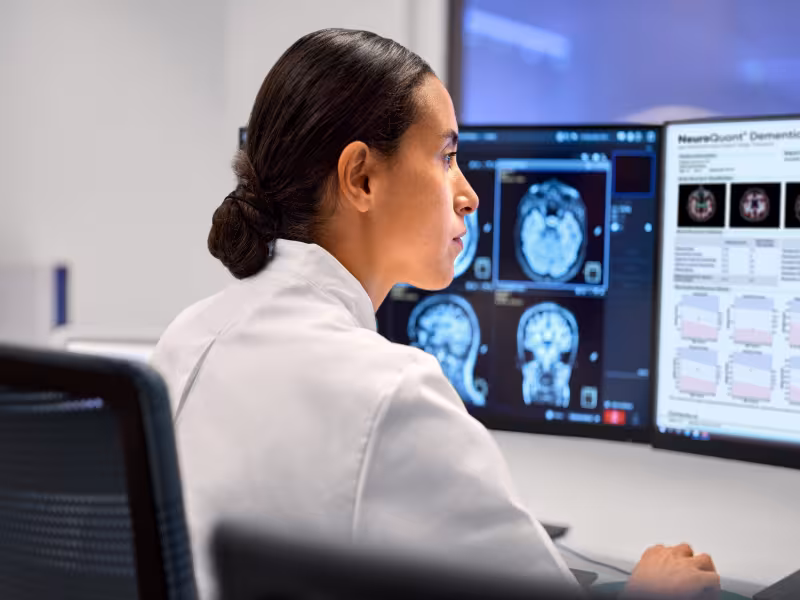 Philips and Cortechs.ai deepen AI partnership to scale quantitative neuroimaging in MR