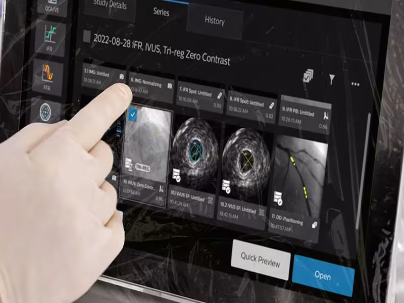 Philips Expands AI-Guided Cardiology Workflow Strategy With Low-Dose Imaging Innovations at EuroPCR 2026