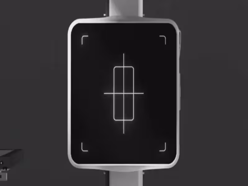 Carestream Launches STARVIEW Digital Radiography System for Routine Imaging