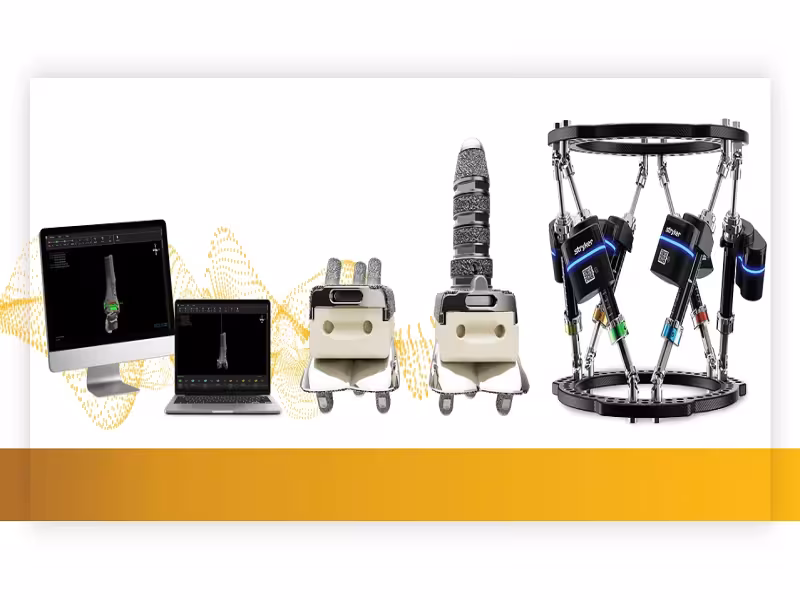 Stryker Adds Prophecy Planning to Incompass Ankle System