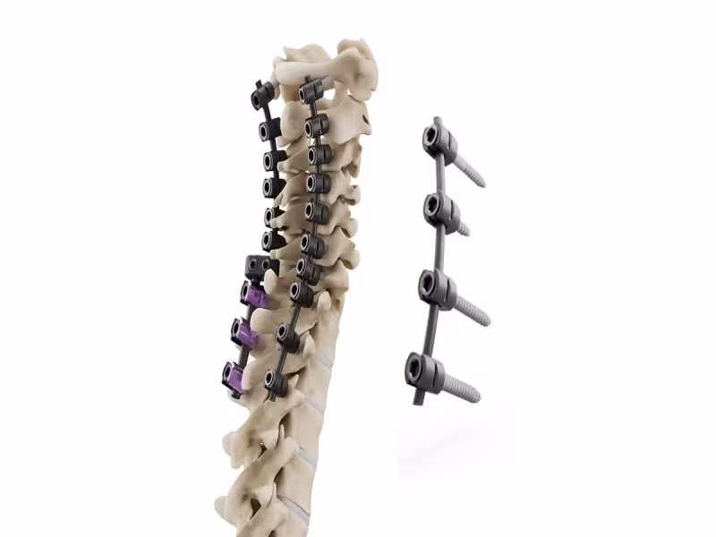 CMS Grants NTAP Reimbursement for icotec's CMORE CT Spine Implant