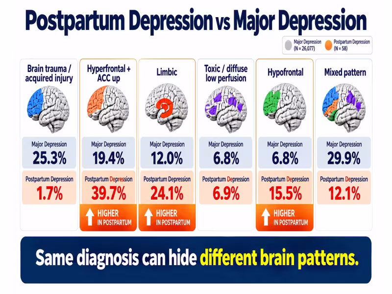 Amen Clinics Study Finds Postpartum Depression Has Distinct Brain Patterns