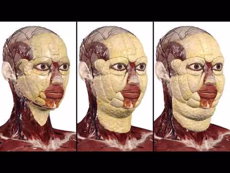 Anatomage Adds Class I, Class III Obesity Models to 3D Table